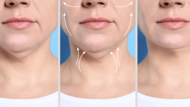 Fat Dissolving Injections