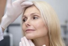 Who Is an Ideal Candidate for a Deep Plane Facelift in London