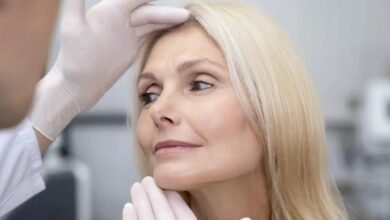 Who Is an Ideal Candidate for a Deep Plane Facelift in London